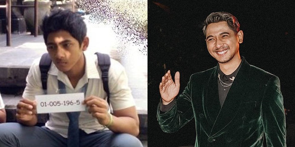 50 seleb sebelum dan sesudah terkenal © Berbagai sumber 50 seleb sebelum dan sesudah terkenal © Berbagai sumber