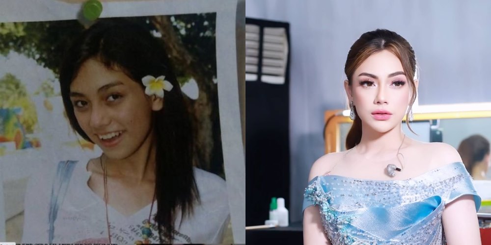 50 seleb sebelum dan sesudah terkenal © Berbagai sumber 50 seleb sebelum dan sesudah terkenal © Berbagai sumber