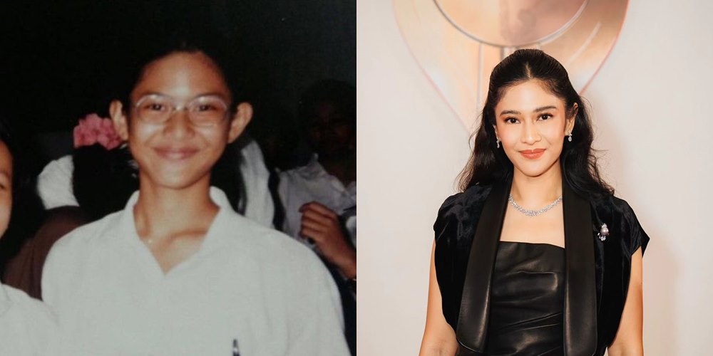 50 seleb sebelum dan sesudah terkenal © Berbagai sumber 50 seleb sebelum dan sesudah terkenal © Berbagai sumber