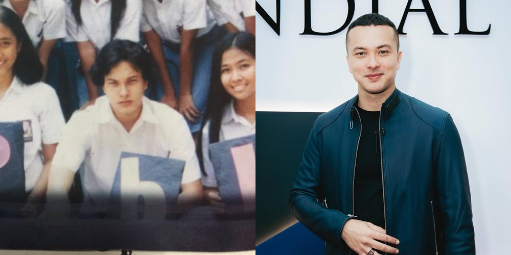 50 seleb sebelum dan sesudah terkenal © Berbagai sumber 50 seleb sebelum dan sesudah terkenal © Berbagai sumber