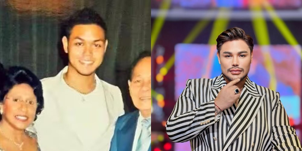 50 seleb sebelum dan sesudah terkenal © Berbagai sumber 50 seleb sebelum dan sesudah terkenal © Berbagai sumber