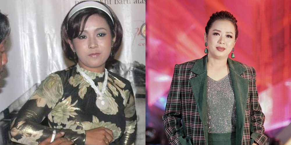 50 seleb sebelum dan sesudah terkenal © Berbagai sumber 50 seleb sebelum dan sesudah terkenal © Berbagai sumber