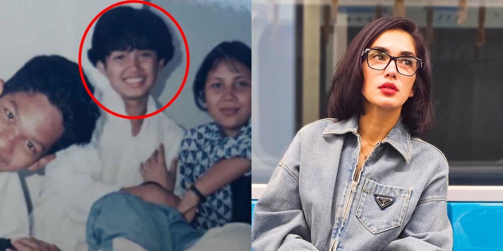 50 seleb sebelum dan sesudah terkenal © Berbagai sumber 50 seleb sebelum dan sesudah terkenal © Berbagai sumber