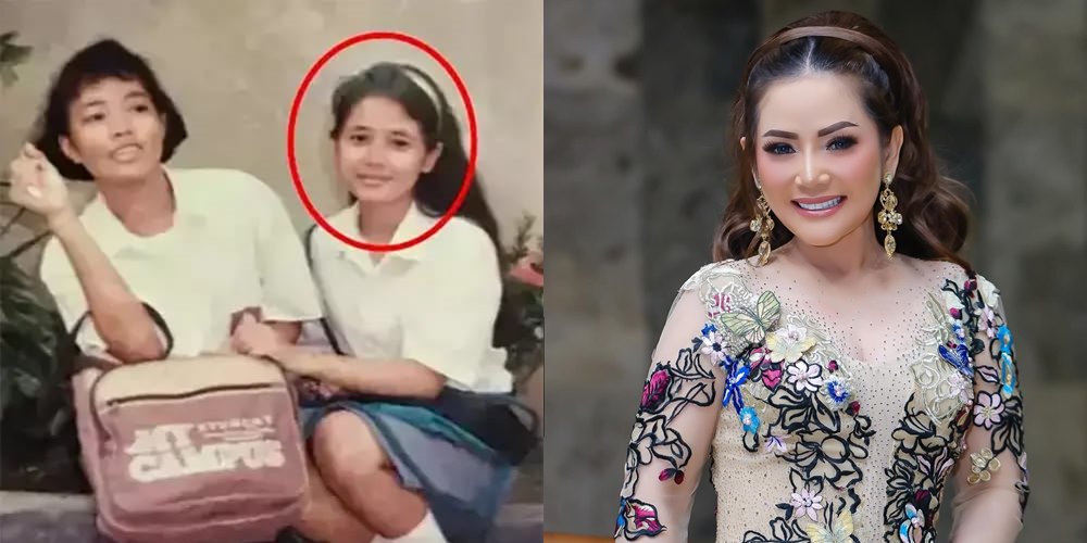 50 seleb sebelum dan sesudah terkenal © Berbagai sumber 50 seleb sebelum dan sesudah terkenal © Berbagai sumber