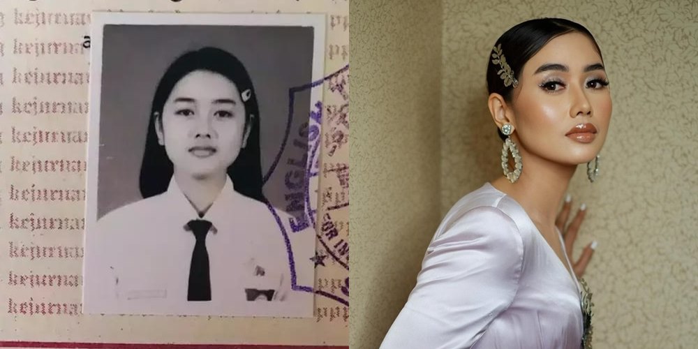 50 seleb sebelum dan sesudah terkenal © Berbagai sumber 50 seleb sebelum dan sesudah terkenal © Berbagai sumber