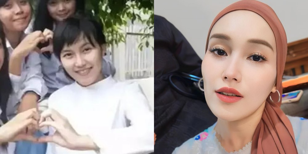 50 seleb sebelum dan sesudah terkenal © Berbagai sumber 50 seleb sebelum dan sesudah terkenal © Berbagai sumber