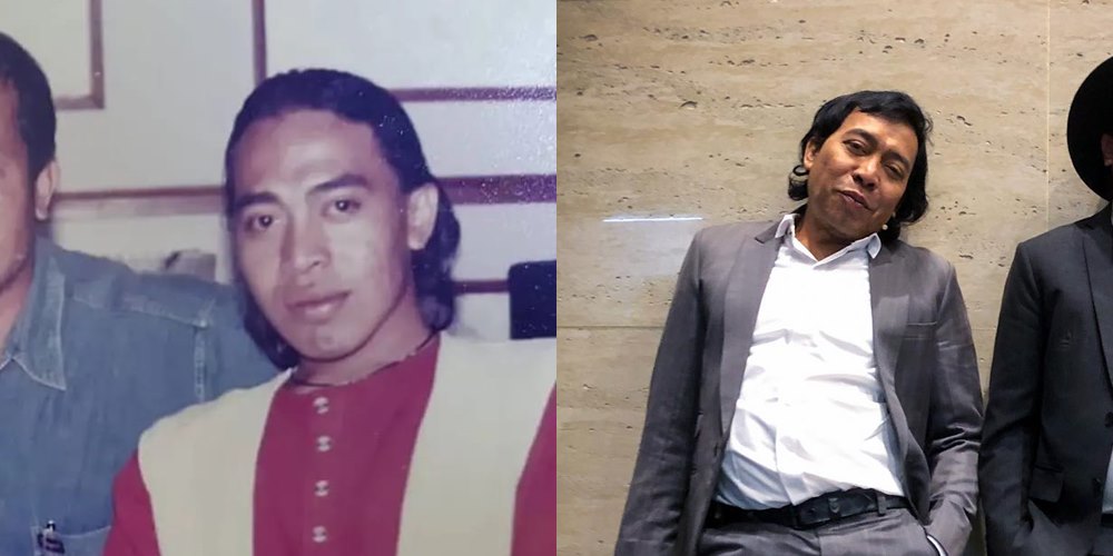 50 seleb sebelum dan sesudah terkenal © Berbagai sumber 50 seleb sebelum dan sesudah terkenal © Berbagai sumber