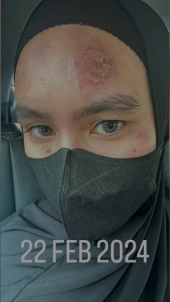 wajah kartika putri kinclong © Instagram