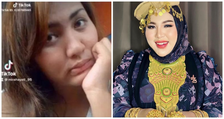 foto dulu dan kini bos skincare © 2024 brilio.net foto dulu dan kini bos skincare © 2024 brilio.net