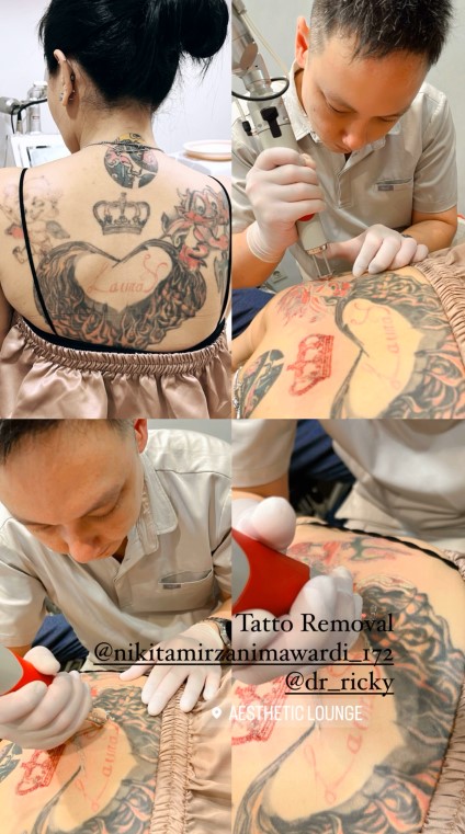Nikita Mirzani hapus tato di punggung © Instagram