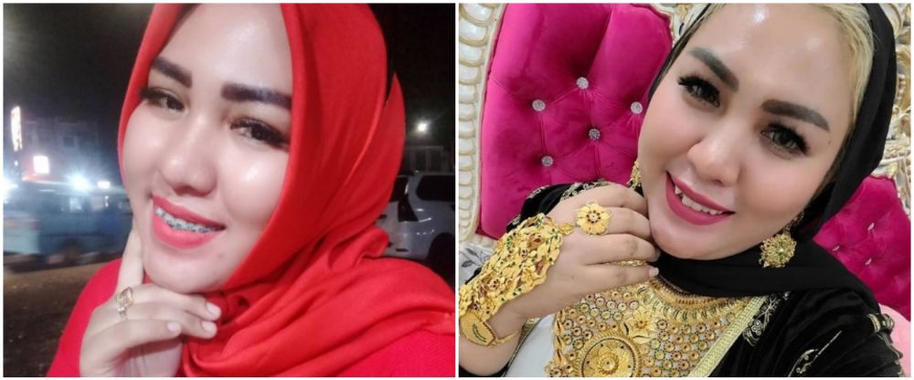 Mira Hayati sebelum sesudah behel © Instagram Mira Hayati sebelum sesudah behel © Instagram