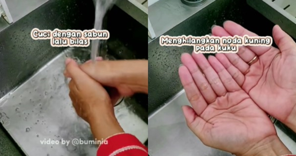 Bukan diolesi baking soda, ini cara cepat hilangkan noda kunyit di tangan pakai 1 bahan sederhana