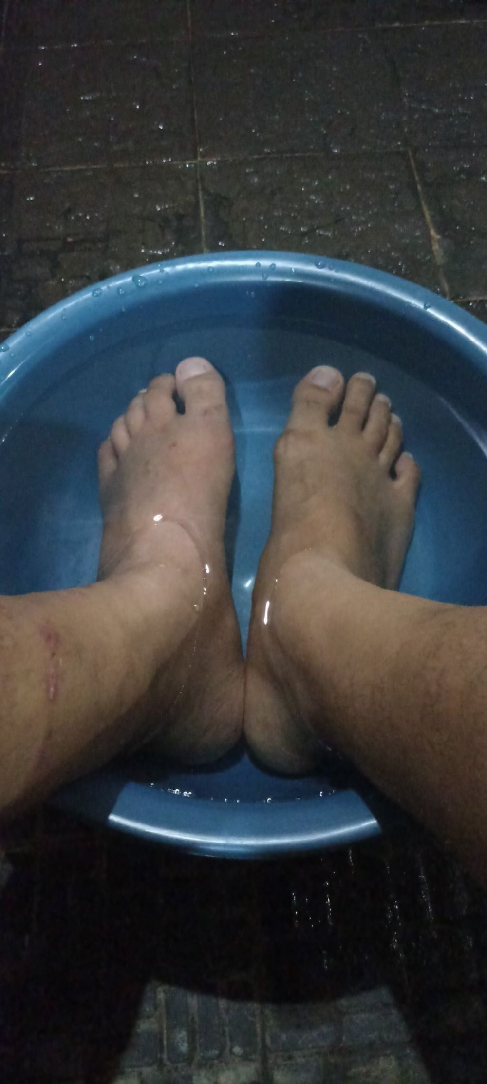 10 Cara ampuh atasi cantengan, solusi aman redakan bengkak dan nyeri