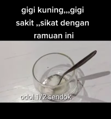 atasi stronggigi kuning/strong ala YouTuber berbagai sumber atasi stronggigi kuning/strong ala YouTuber berbagai sumber
