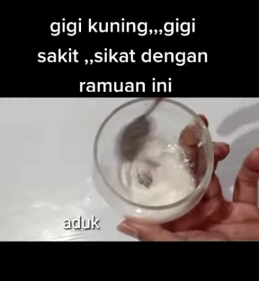 atasi stronggigi kuning/strong ala YouTuber berbagai sumber atasi stronggigi kuning/strong ala YouTuber berbagai sumber