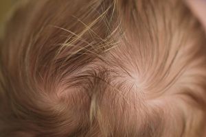 Benarkah anak punya dua pusar kepala itu nakal? Ini penjelasannya