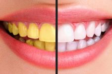 Tips bikin gigi putih bersih dengan buah-buahan, jadi senyum terus nih