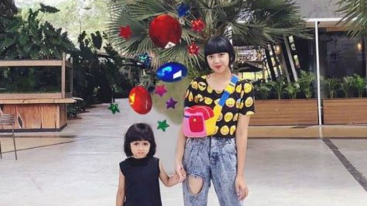 Mengenal 'Vetiligo' kelainan kulit yang diderita anak Diana Rikasari