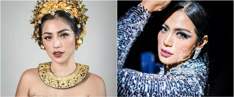 Jessica Iskandar disebut mirip Lucinta Luna usai operasi hidung, potret terbarunya bikin pangling