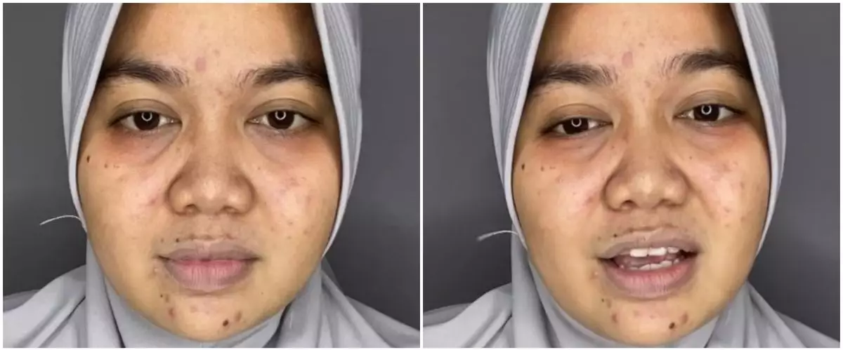 Wanita berjerawat ini automulus berkat makeup, transformasinya dandan soft glam jadi manglingi pol