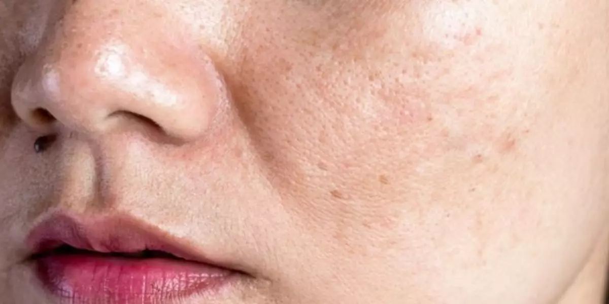 Trik mencerahkan kulit kusam hanya pakai 1 jenis biji-bijian, tak perlu beli serum vitamin C