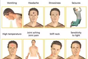 Begini cara pencegahan penyakit meningitis yang serang Olga