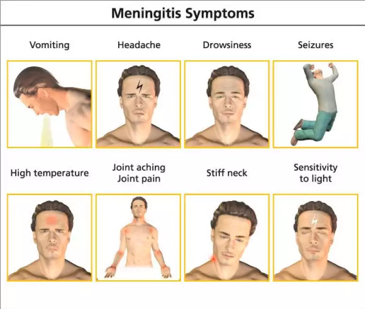 Begini cara pencegahan penyakit meningitis yang serang Olga