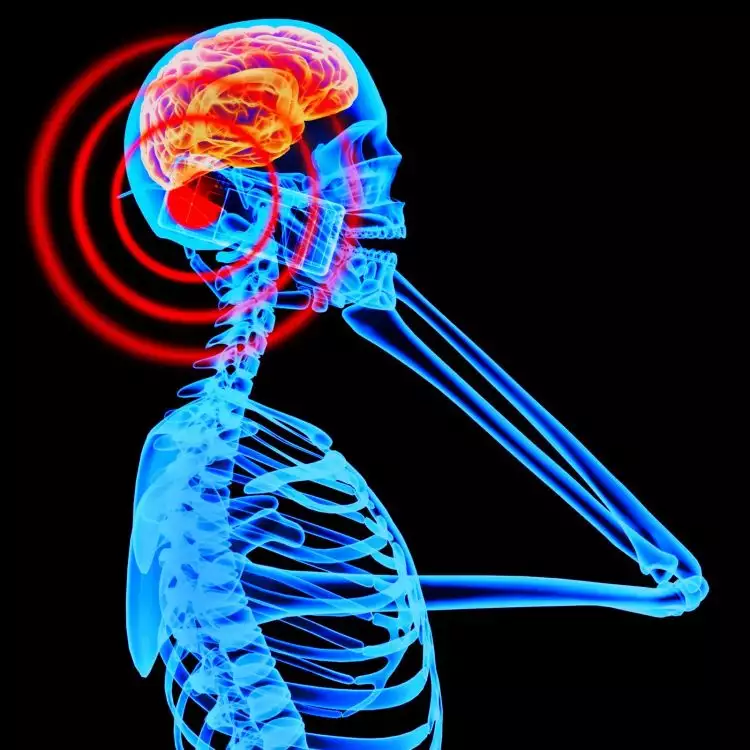Radiasi ponsel bisa picu kanker otak