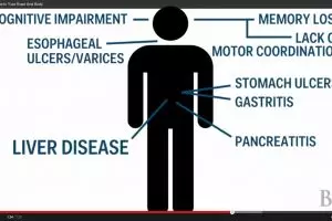 VIDEO: Suka minuman alkohol? Otak dan tubuhmu terancam banyak penyakit