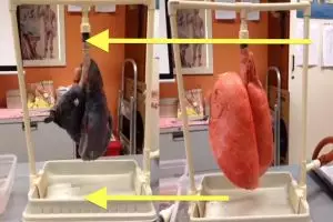 VIDEO: Masih berani merokok setelah melihat paru-paru perokok ini?