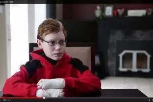 VIDEO: Anak ini harus dibalut mirip mumi jika mau dimandikan ibunya