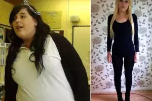 Sukses diet, gadis ini justru ingin gemuk lagi gara-gara kena penyakit