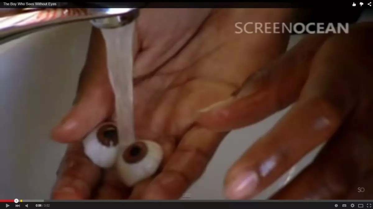 VIDEO: Anak ekolokasi ini bisa 'melihat' bukan dengan mata, luar biasa