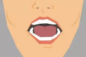 Gusi kamu tiba-tiba berdarah? Ini 5 cara jitu mengatasinya