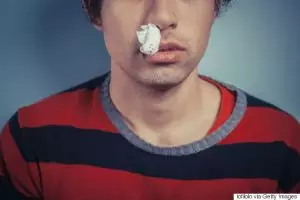 7 Cara mencegah agar kamu tak gampang mimisan