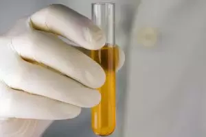 Mengapa air seni kamu berwarna kuning? Ini penjelasan ilmiahnya