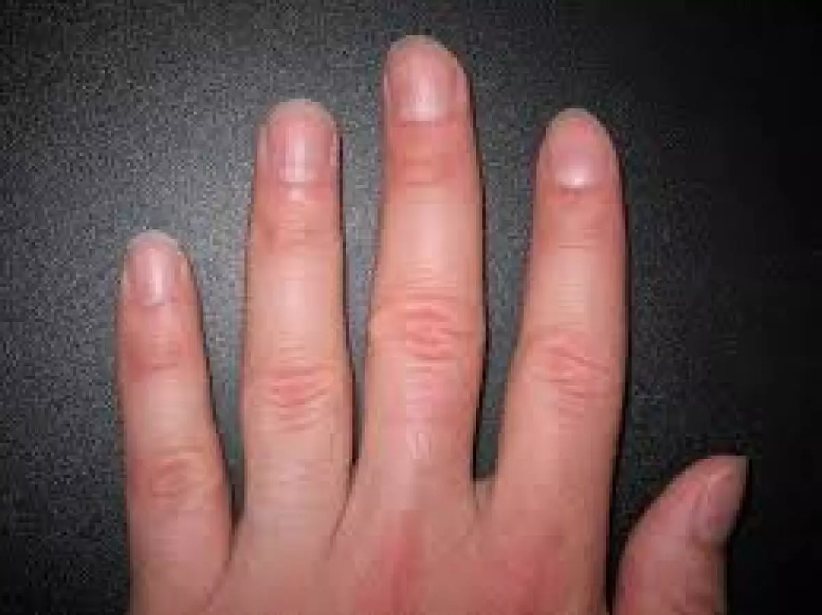 Ini dia caranya bikin kuku kamu makin kuat