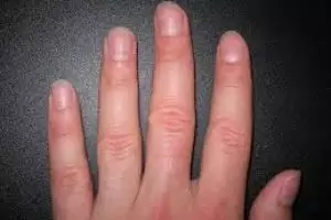 Ini dia caranya bikin kuku kamu makin kuat