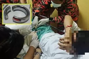 Jangan ditiru! Pasang cincin di 'anu', pria ini terpaksa dioperasi