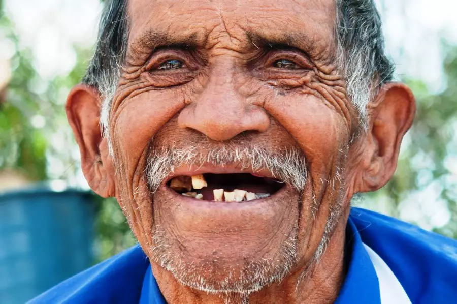 Gigi tanggal pada orang dewasa pertanda mulai pikun