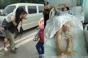 Lindungi bayi, ibu di China terkena 19 gigitan anjing