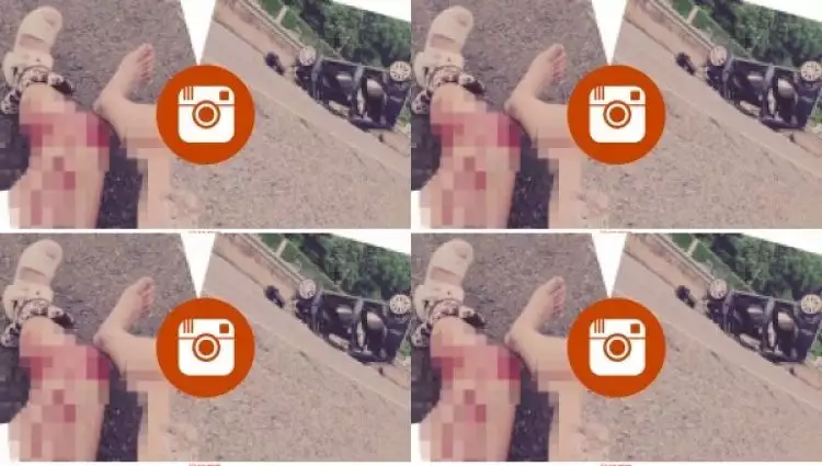 Selfie setelah kecelakaan, ulah wanita ini disayangkan banyak orang