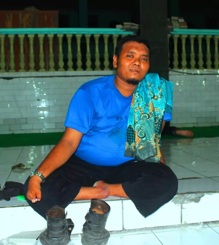 Terlahir dengan fisik tak sempurna, Alim pantang jadi peminta-minta