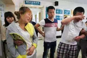 Pipis di gardu listrik, tubuh bocah 7 tahun melepuh dan harus amputasi