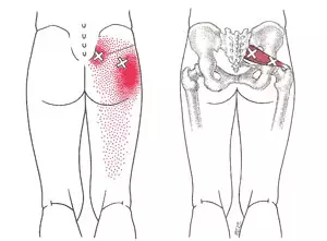 Stop kebiasaan menaruh dompet di saku belakang, ini bahayanya!