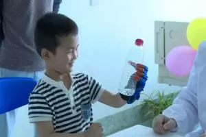 Anak ini tersenyum kembali setelah dipasangkan tangan 3D