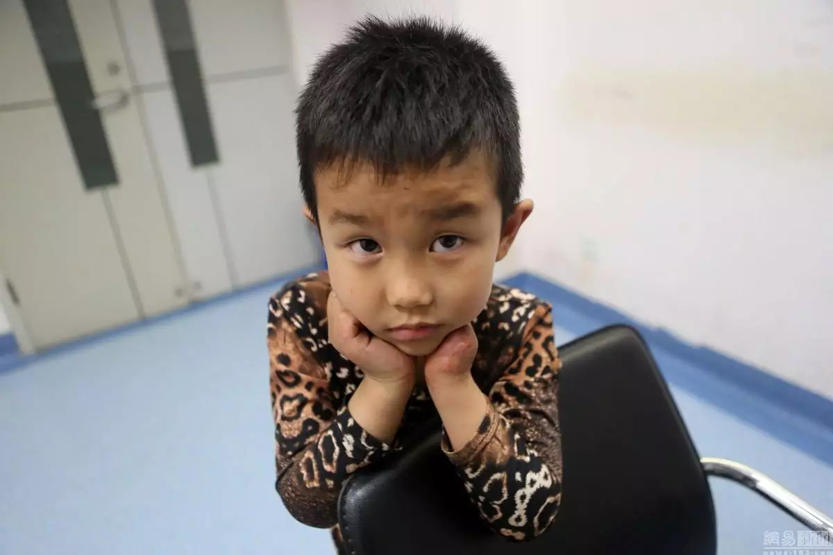 Anak ini tersenyum kembali setelah dipasangkan tangan 3D