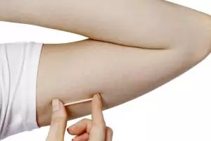Dipasang di lengan, tapi kok bisa susuk KB cegah kehamilan?
