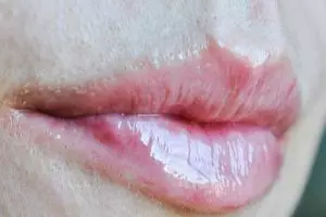 Pengen bibir seksi kayak Kylie Jenner? Kamu cuma perlu kayu manis