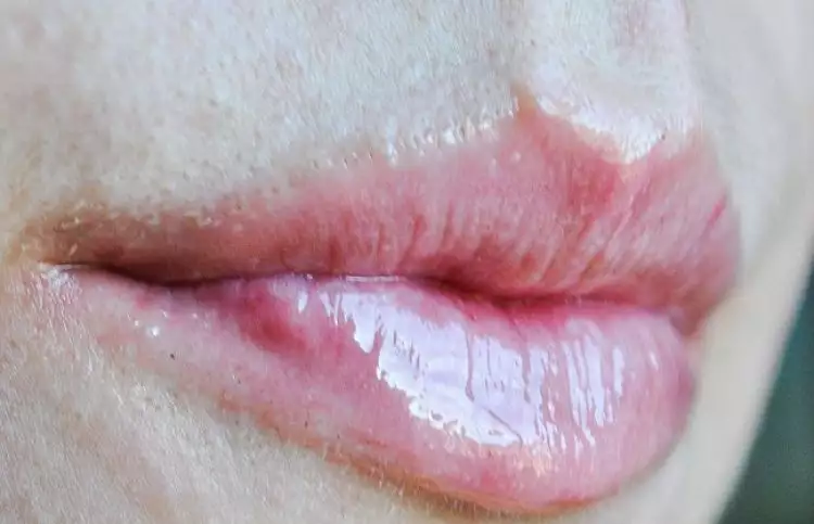 Pengen bibir seksi kayak Kylie Jenner? Kamu cuma perlu kayu manis
